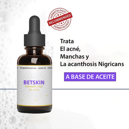 (LLEVA 2x1)🎁 GINGER OIL™ ACNÉ + MANCHAS + ACANTOSIS NIGRICANS